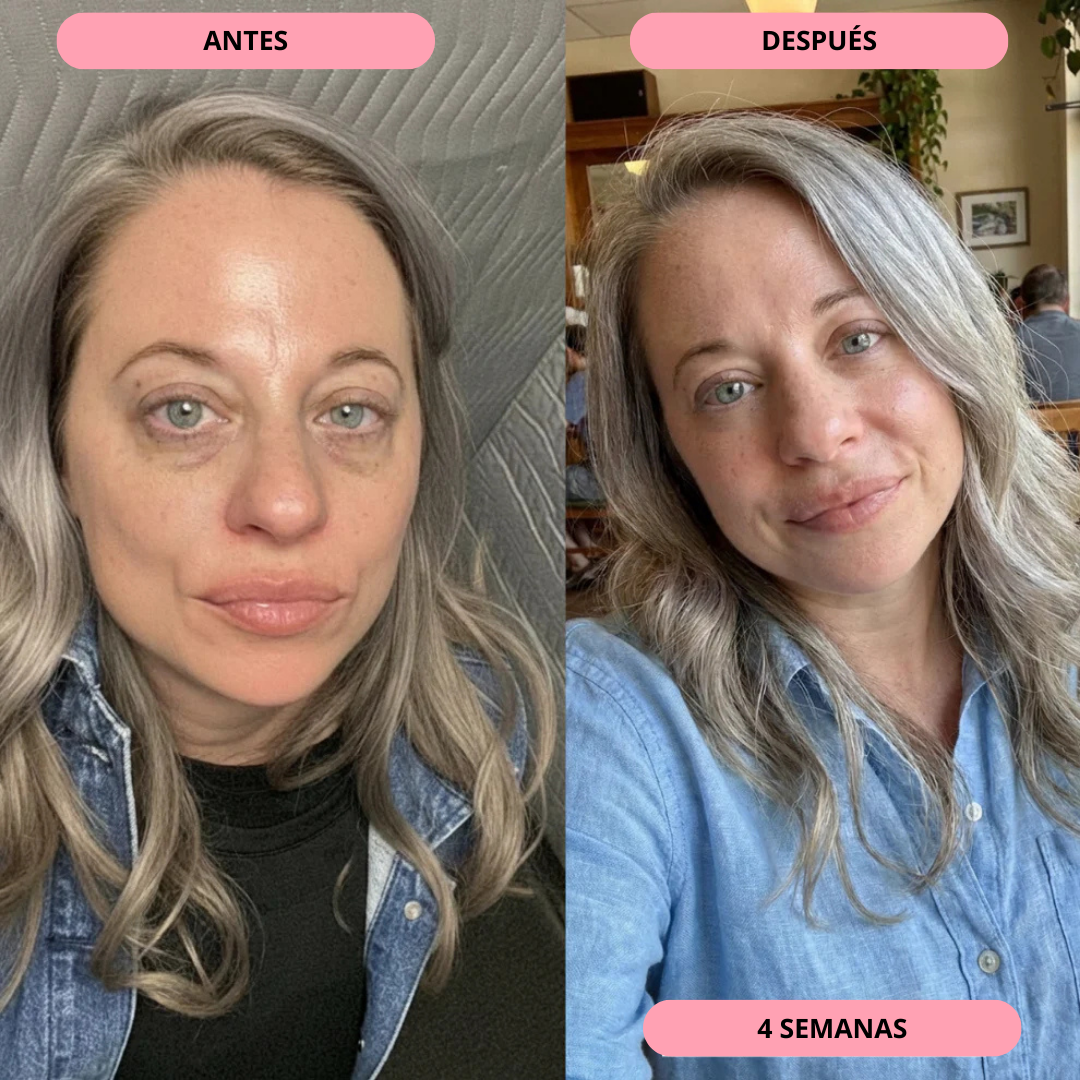 Tratamiento para ojeras Keysly