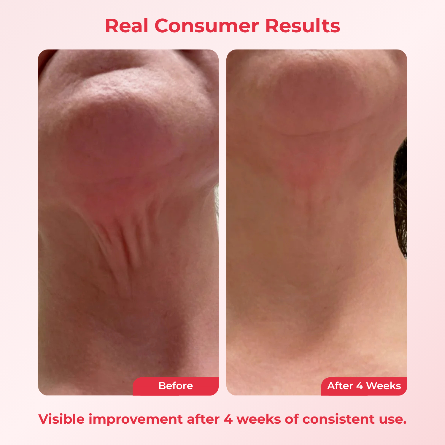 Crema Reversora del Tiempo para el Cuello