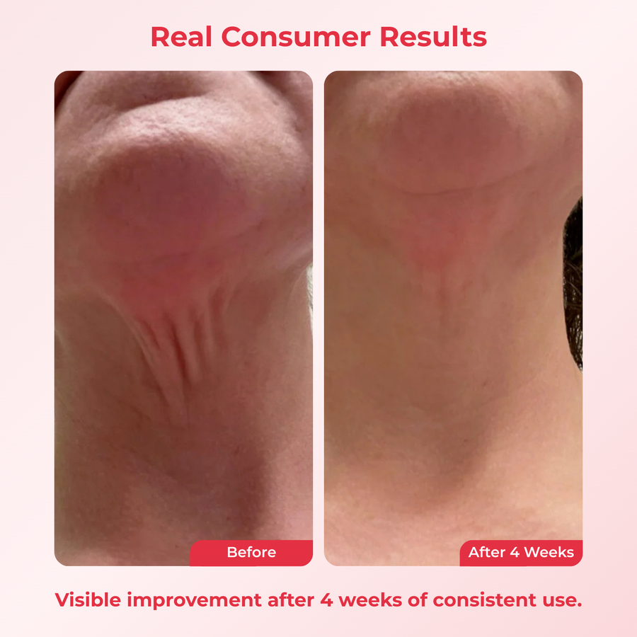 Crema Reversora del Tiempo para el Cuello