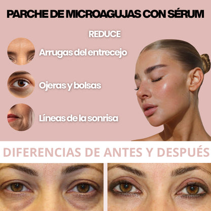 Parches MicroGlow Keysly